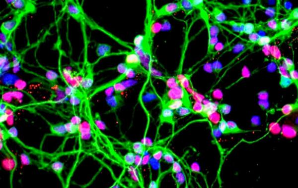 Neurons growing in a culture dish (NASA)