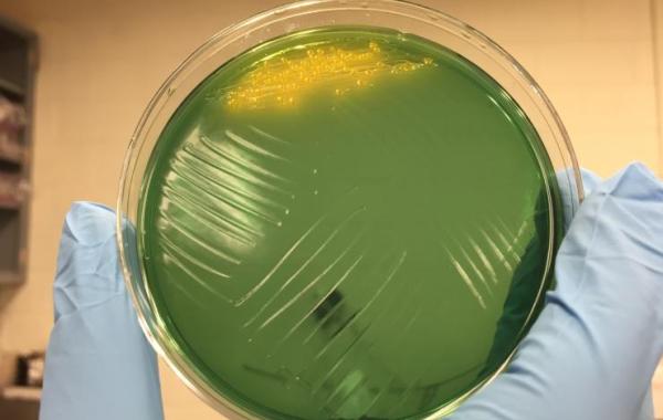 Cholera on Agar Plate