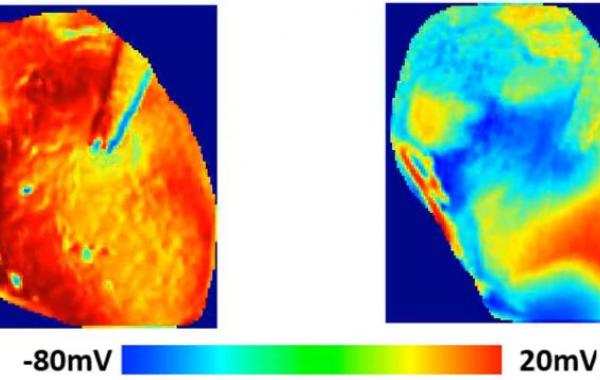 Electrical wave pattern on heart