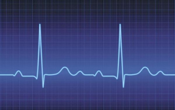 Electrocardiogram trace of the heart