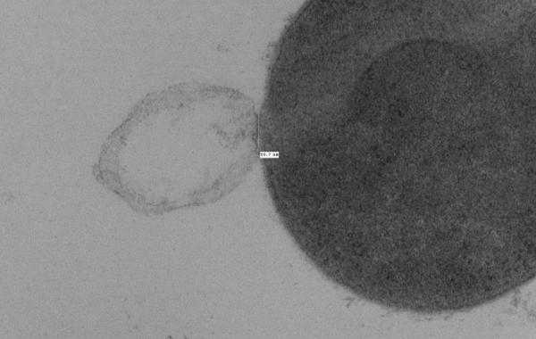 Bursting a Bacteria Cell Wall2