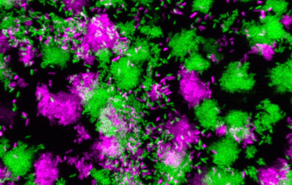 Pseudomonas aeruginosa clumps grown in synthetic cystic fibrosis sputum. 