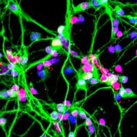 Neurons growing in a culture dish (NASA) Neurons growing in a culture dish (NASA)