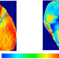 Electrical wave pattern on heart