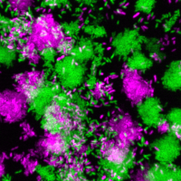 Pseudomonas aeruginosa clumps grown in synthetic cystic fibrosis sputum. 